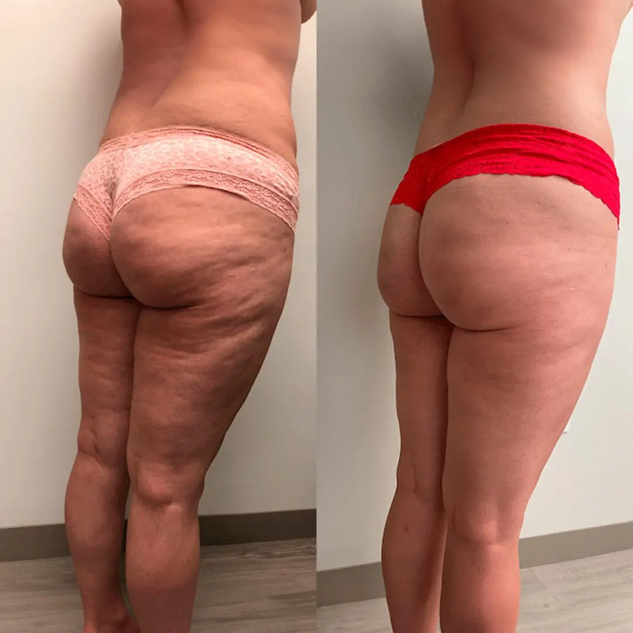 Customer result photo