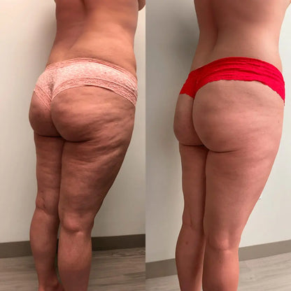 The Original Sculpiflex™ 3-in-1