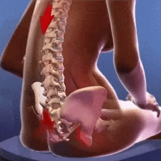 Vela X™ All-in-1 Spinal Decompression & Restoration System