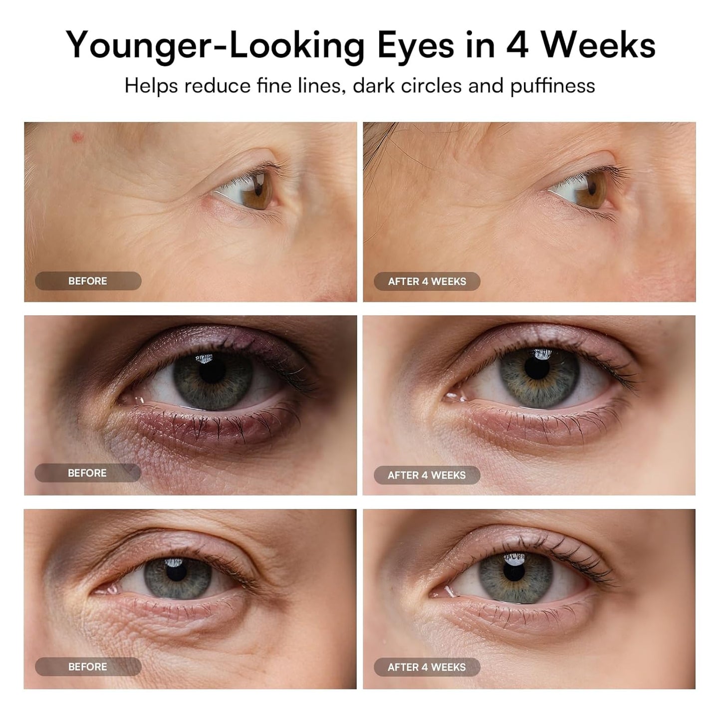 Vela X - Red Light Therapy Eye Mask