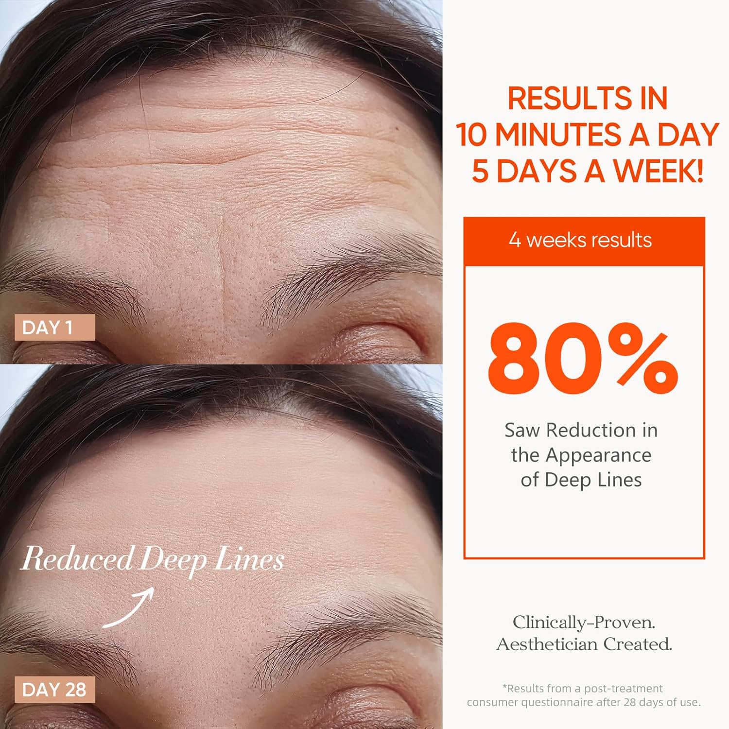 Vela X Radiance Mask Advanced