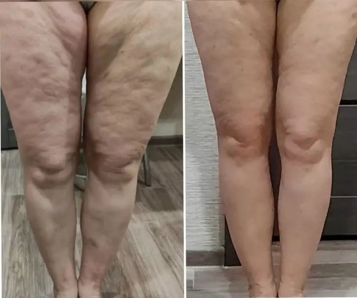 The Original Sculpiflex™ 3-in-1