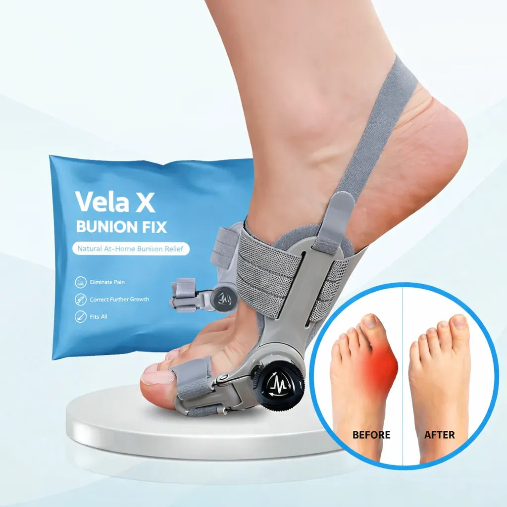 Vela X Bunion Fix
