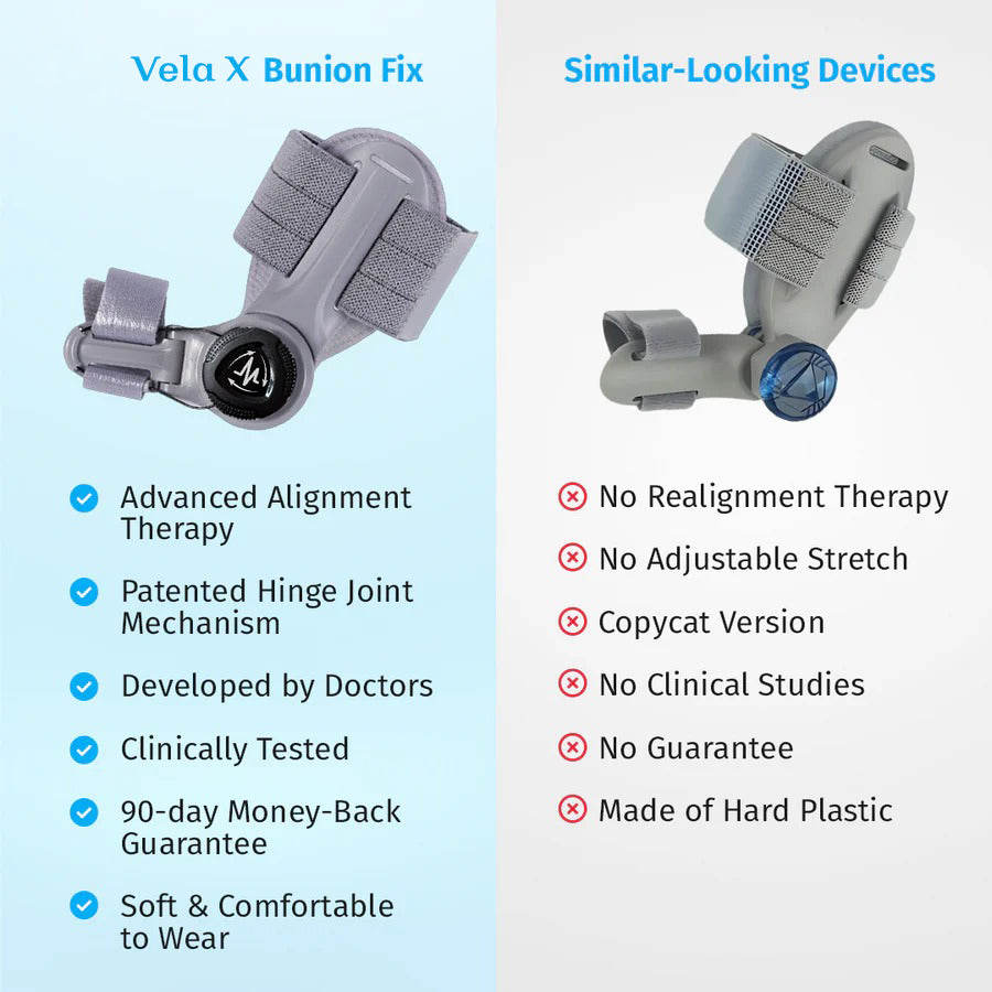 Vela X Bunion Fix