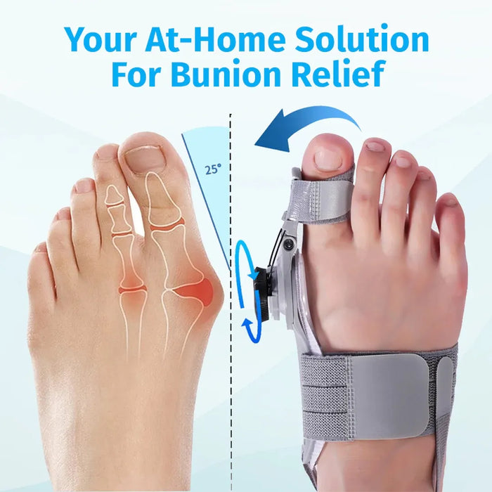 Vela X Bunion Fix
