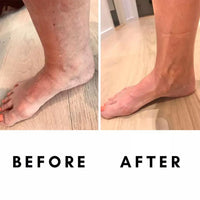Vela X SculptFlow™ - Sculpting & Cupping Therapy