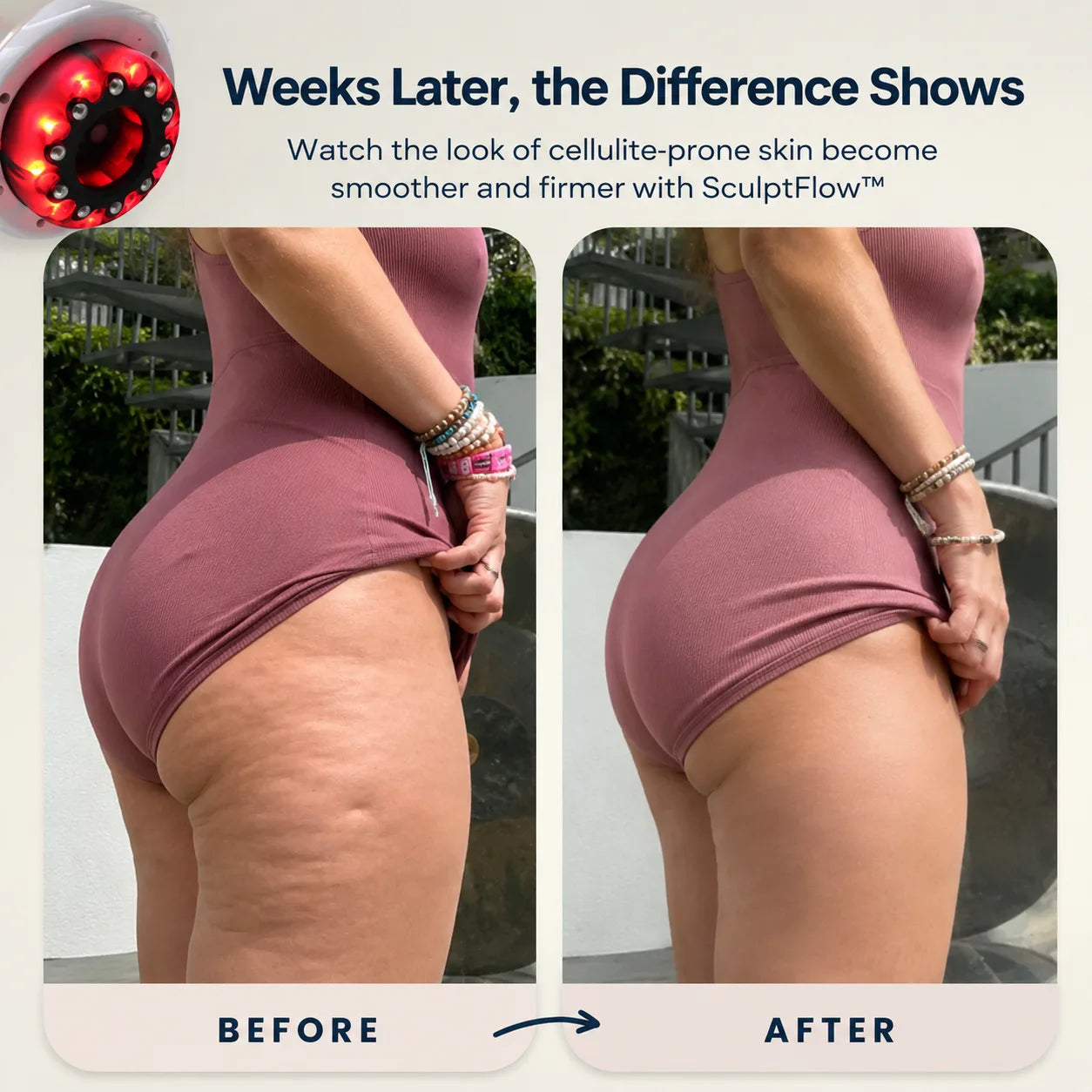 Before and after using SculptFlow