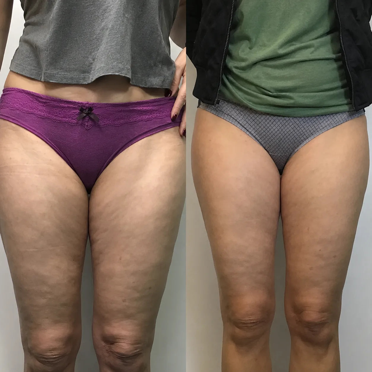 Before and after results grid
