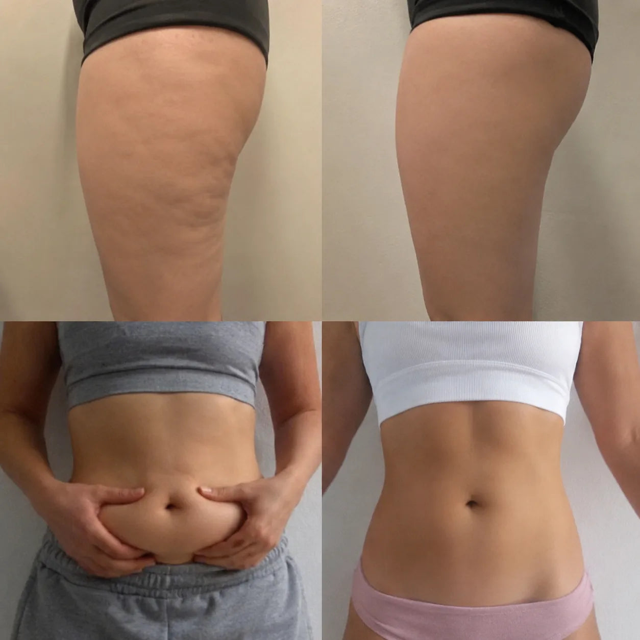 Before and after thighs