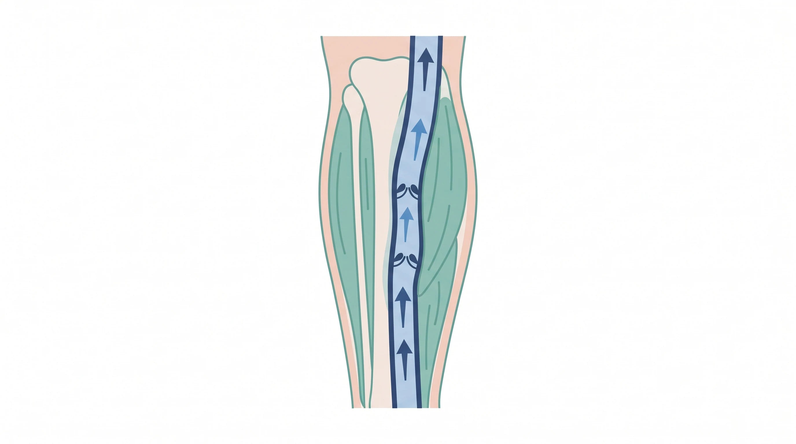 Cross-section of the calf showing the muscle pump squeezing the deep vein and pushing fluid upward